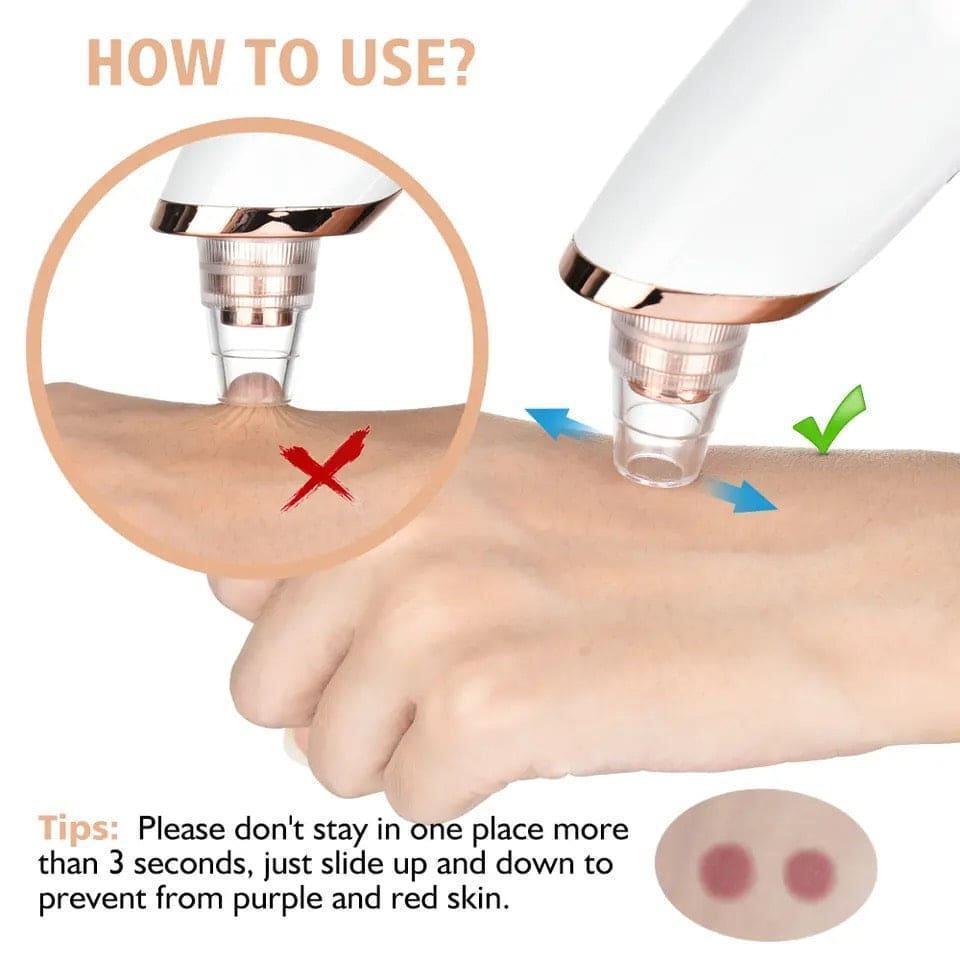 Deep Pore Vacuum Blackhead Remover